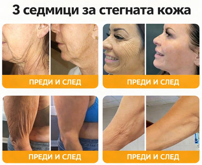 ❤️❤️𝐀𝐕𝐒𝐀𝐕𝐒™ Комплексен крем с пчелна отрова - ПОСЛЕДЕН ДЕН: 𝟖𝟎% отстъпка! (отпусната кожа, фини бръчки, загуба на стегнатост, плосък бюст, отпуснати ханша и други)