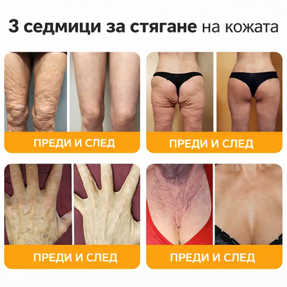 ❤️❤️𝐀𝐕𝐒𝐀𝐕𝐒™ Комплексен крем с пчелна отрова - ПОСЛЕДЕН ДЕН: 𝟖𝟎% отстъпка! (отпусната кожа, фини бръчки, загуба на стегнатост, плосък бюст, отпуснати ханша и други)
